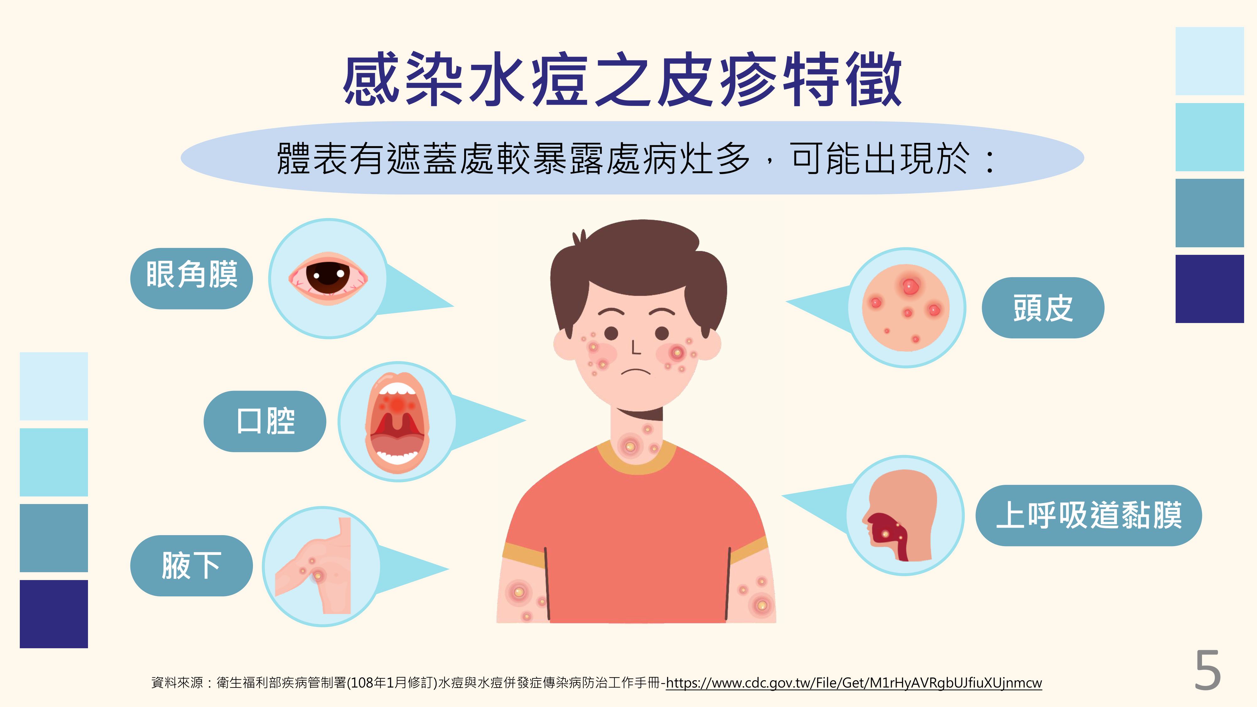 感染水痘之皮疹特徵-衛福部疾管署宣導海報