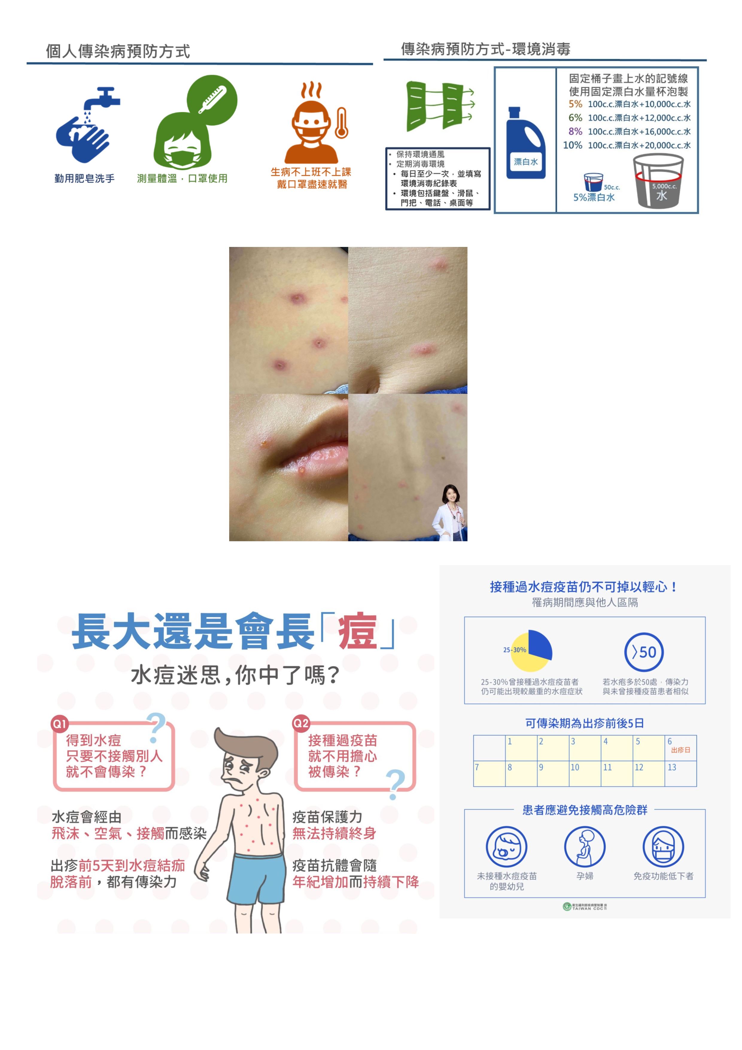 水痘預防方式